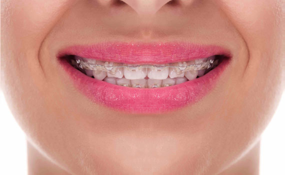 全口重建,牙科,美學,牙周,植牙,口腔,牙齒,貼片,美白貼片,牙齒美白,數位矯正,植牙美學,微笑曲線,根管治療